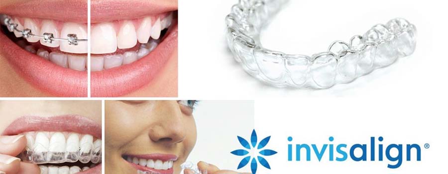 Asha Dental Clinic Orthodontic And Implant Care