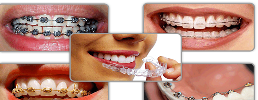Asha Dental Clinic Orthodontic And Implant Care