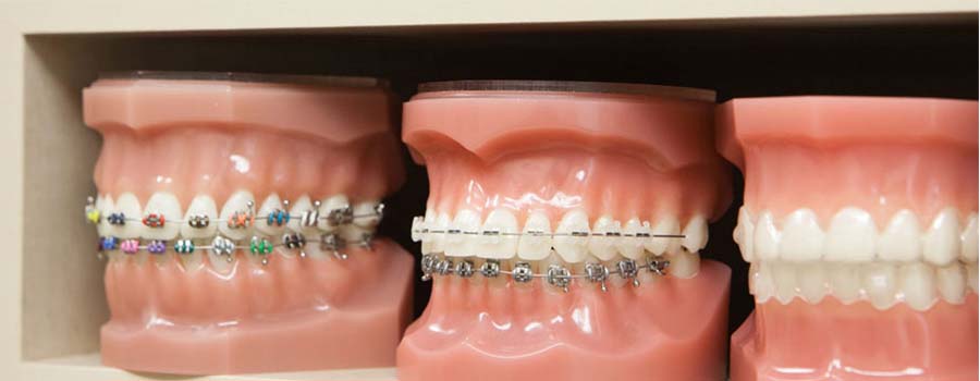 Asha Dental Clinic Orthodontic And Implant Care