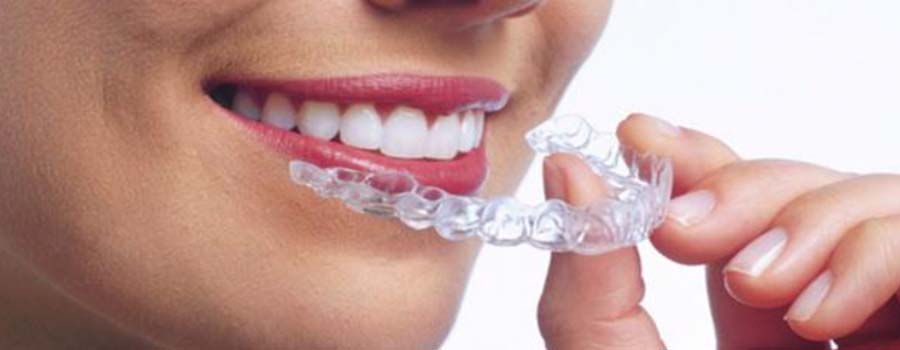 Asha Dental Clinic Orthodontic And Implant Care