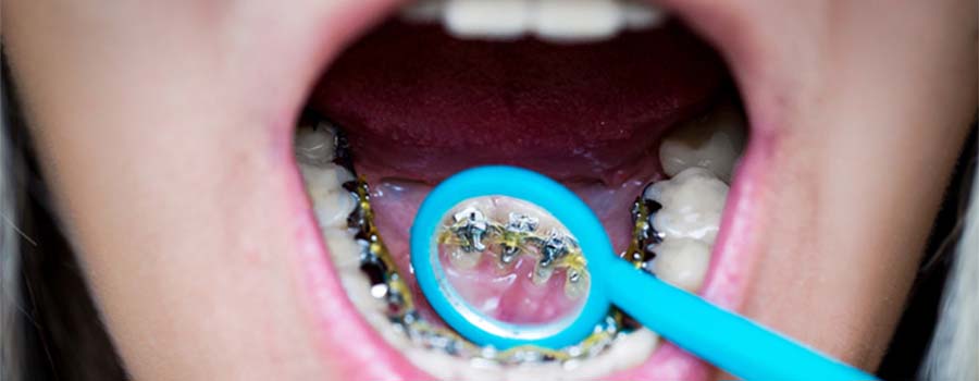 Asha Dental Clinic Orthodontic And Implant Care